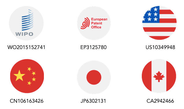 Catheter ablation photo